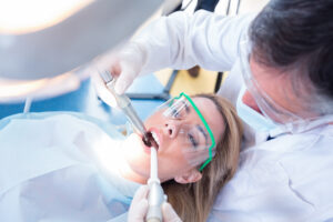 Quanto dura la pulizia dei denti